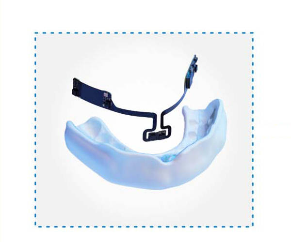custom-fit mouthguard created and embedded with data sensors