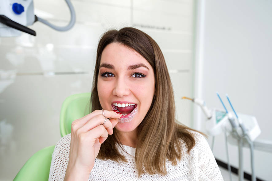 Lady putting in her clear aligners